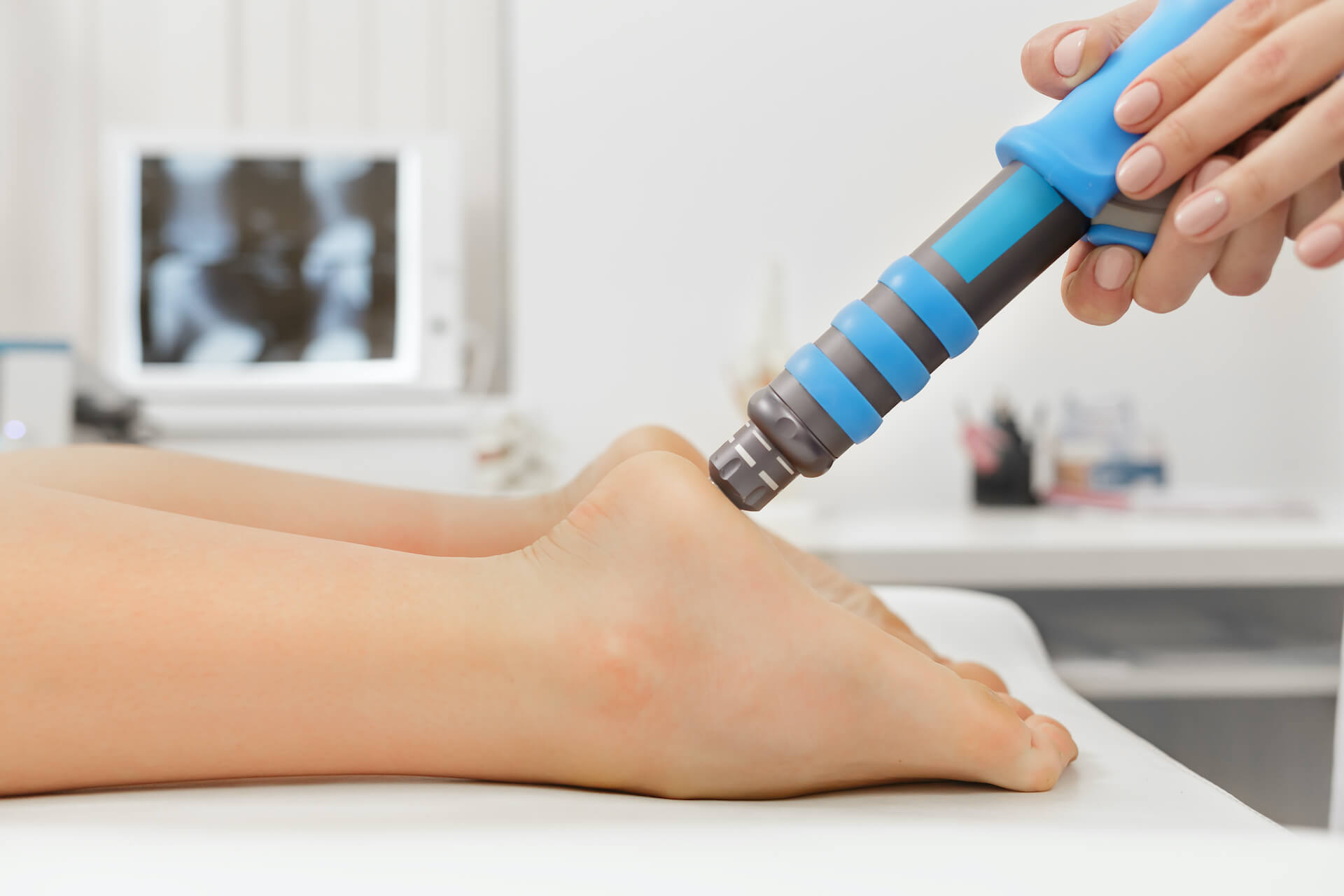 shockwave-therapy
