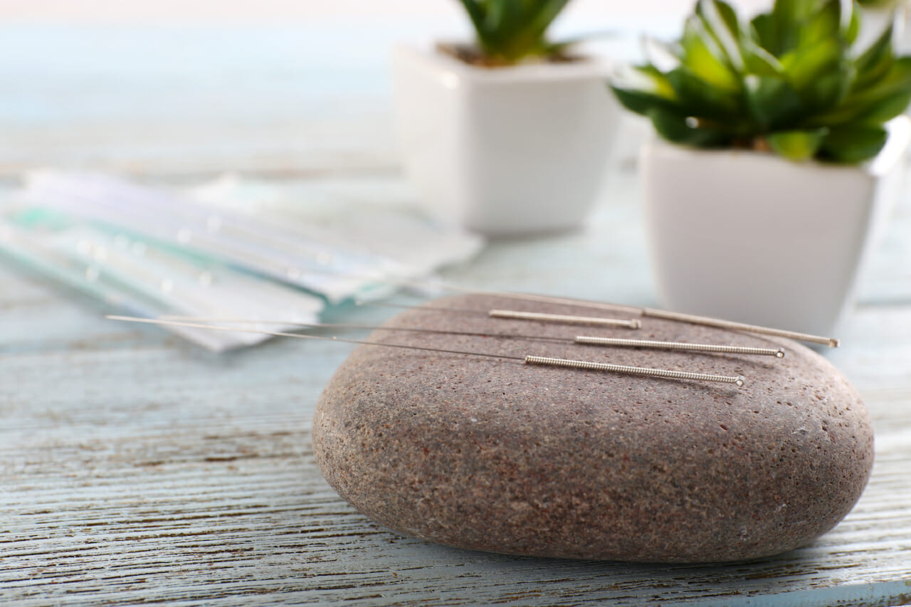 Acupuncture Orleans