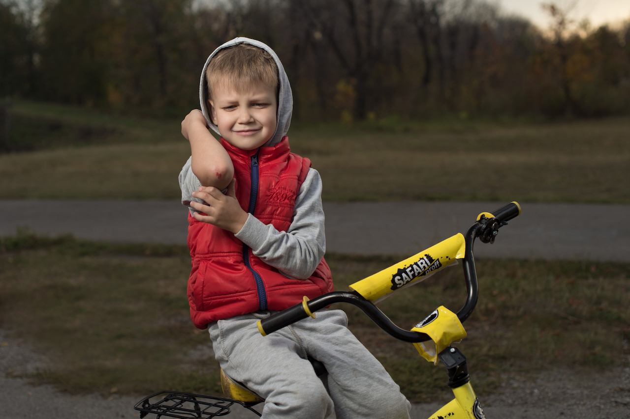 Elbow and Wrist Pain treatment